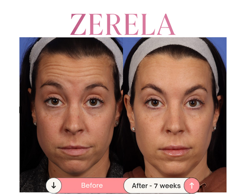 Zerela Wrinkle Repair Wand